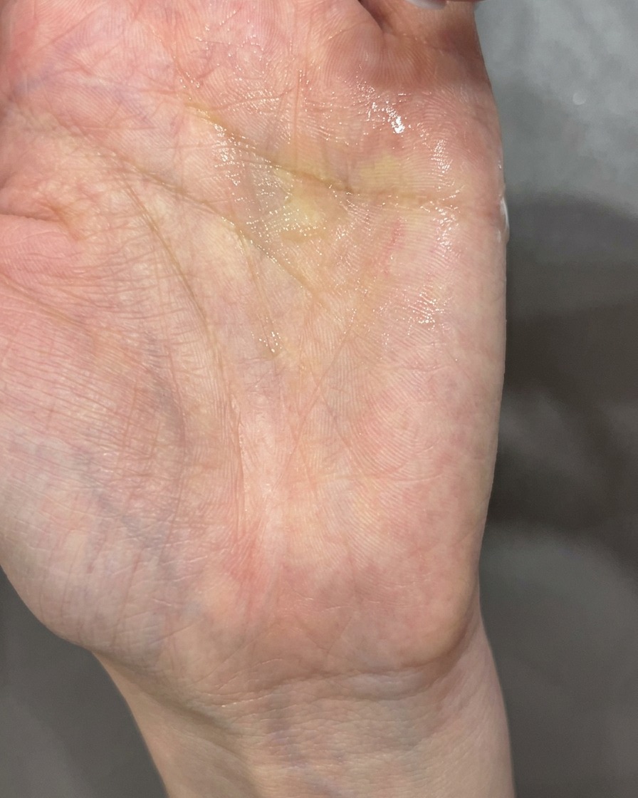 Zbliżenie na paznokieć z dwoma białymi rzeźbionymi płatkami układanymi w kształt kwiata.